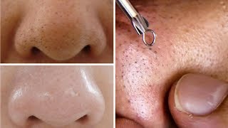 How To Do Facial Clean Up At Home Step By Step For Spotless Clear Skin Rabia Skincare [upl. by Adiehsar]