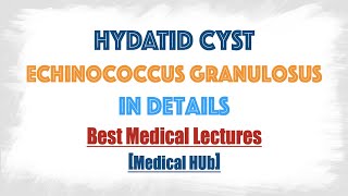 Hydatid cyst of Echinococcus granulosusDog tapeworm  Discussed in details everything you need [upl. by Corene]