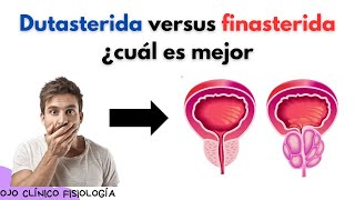 🔴 TAMSULOSINA DUTASTERIDA VS FINASTERIDA PARA LA HIPERPLASIA PROSTÁTICA BENIGNA ¿CUÁL ES MEJOR [upl. by Yetnruoc]