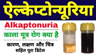 Alkaptonuria in hindi class 12 biology  black urine disease  ऐल्केप्टोन्यूरिया Biology ScienceSK [upl. by Ahtera]