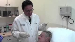 Skin Tag Removal Demonstration by Dr Ricardo Mejia [upl. by Balbur]