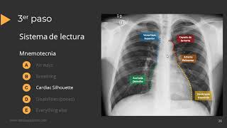 Tutorial Radiografía de Torax [upl. by Nhguaved]