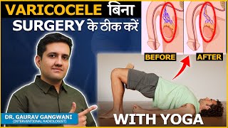 Yoga for Varicocele Relieve Pain and Promote Circulation  Dr Gaurav Gangwani [upl. by Artkele]