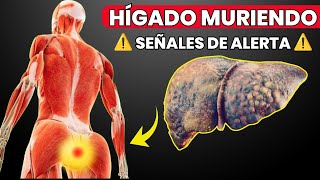 13 Signos Extraños de DAÑO en el HÍGADO [upl. by Roe]