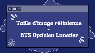 Taille dimage rétinienne  BTS [upl. by Akcimahs]