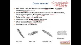 Renal pathology part 1 Glomerular disease and urine caste video from USMLE First Aid Step One [upl. by Nelson585]