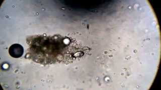 Microscope Sputum Analysis  Ciliated Cells Wiggly Wiggly [upl. by Stalker]