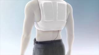 LifeVest Patient Education Video Chapter 3 Wearing the LifeVest [upl. by Keegan]