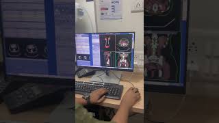 3D reconstruction ct Urography ctscan ctscantechnician trendingshorts tyshorts shortvideo [upl. by Cairistiona300]