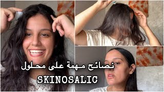 اجوبة على اسئلتكم بالنسبة علاج لي كندير لقشرة نصائح مهمة على محلول SKINOSALIC [upl. by Gowrie]