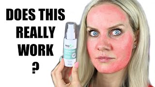 Does ROSACEA Cream REALLY WORK Esthetician Tries for the FIRST TIME [upl. by Noonan568]