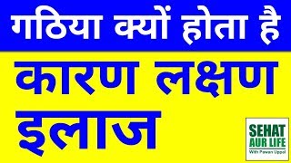 Arthritis Bimari Kya Hai Causes Symptoms Treatment Gathiya Rog Ke Lakshan ilaj Karan In Hindi [upl. by Aneahs931]