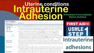 Intrauterine adhesions Asherman syndrome in HindiUrdu by first aid for USMLE step 1 [upl. by Landmeier]