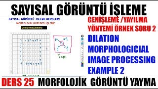 25 Genişleme  Dilation Örnek Soru 2 Morfolojik Görüntü Metodu  Sayısal Görüntü Image Processing [upl. by Orin373]