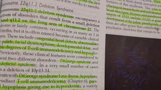 Chromosome 22q112 Deletion Syndrome General Patho  PATHOLOGY [upl. by Girand]