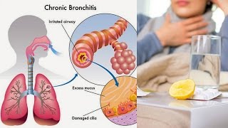 How to Get Rid of PHLEGM in Lungs  THIS TEA FULLY EJECTS PHLEGM FROM THE LUNGS [upl. by Oileve]