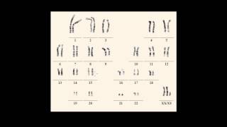 Karyotype notations [upl. by Ahsillek51]