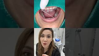 How Does Dentist Change Patient’s Teeth Midline [upl. by Woodall161]