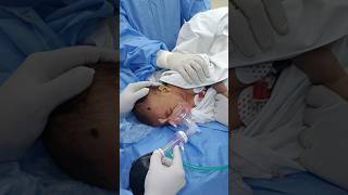 Baby wakes up after surgery Anesthesia [upl. by Ellinnet210]