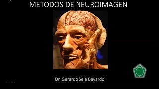 NEUROIMAGEN 1A PARTE [upl. by Adlaremse]