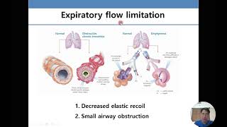 폐기능 검사의 이해와 해석 Pulmonary function test [upl. by Tarah]