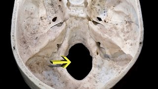 MNEMONIC  Foramen Magnum [upl. by Kaitlyn]