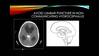 Cerebrospinal fluid [upl. by Llyrat]