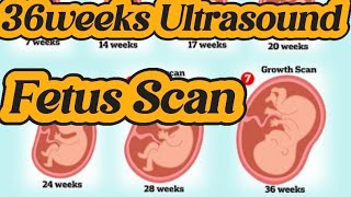 Ultrasound 9 month Pregnancy  36 weeks Pregnancy  Normal delivery  C Section  Obs Anomaly Scan [upl. by Esinehc]