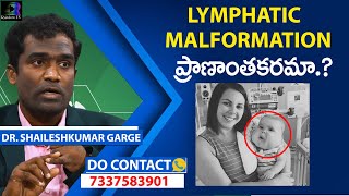 Lymphatic Malformation Causes Symptoms and New Treatment By Dr Shaileshkumar at CitiVascularCentre [upl. by Ylra]