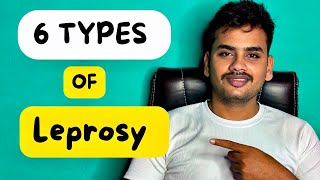 SIX TYPES OF LEPROSY  LEPROSY TREATMENT INFORMATION  suchakwanjari [upl. by Falito]