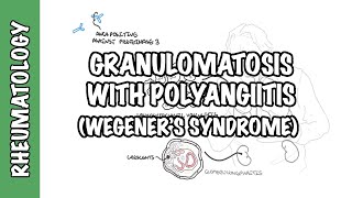 Granulomatosis with Polyangiitis pathophysiology symptoms treatment [upl. by Arsi]