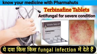 Terbinaforce tablets  Terbinafine tablets ip 250 mg  terbinafine tablets ip 250 mg uses in hindi [upl. by Neiluj]