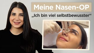 Nasenkorrektur in der Dorow Clinic  Erfahrungsbericht von Selina [upl. by Nasho]