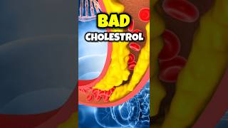 quotTop Tips to Lower Bad Cholesterol Fastquot shorts [upl. by Conway782]