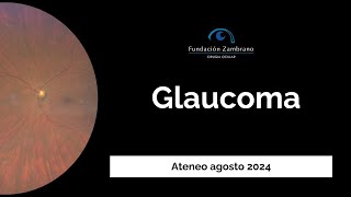 Fundacion Zambrano Ateneo Glaucoma [upl. by Aineg]