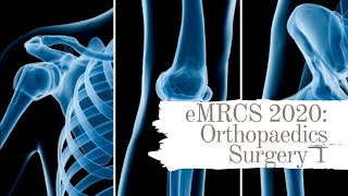 eMRCS 2020 Orthopaedics Surgery 1 [upl. by Gallenz225]