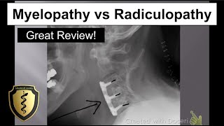 Myelopathy vs Radiculopathy  Great Review [upl. by Engelbert]