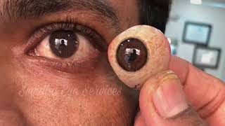 3D Artificial Eye Made by Ocularist Ravikant Sharma in Phthisis Bulbai Case [upl. by Atterol89]