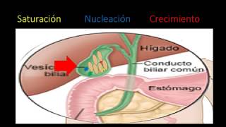 Fisiopatologia de la colelitiasis [upl. by Ynavoj]