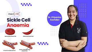 Sickle Cell Anaemia  Pathogenesis  Factors  Diagnosis by DR Priyanka Sachdev  MedLive [upl. by Kwei]