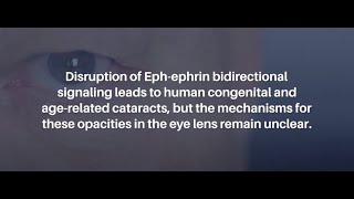 EphA2 Signaling in Eye Lens Aging WildType Knockout and Aging Mice  AgingUS [upl. by Mor303]