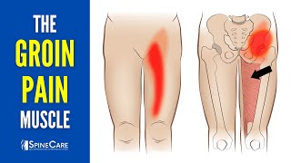 The Groin Pain Muscle How to Release It for INSTANT RELIEF [upl. by Oizirbaf775]