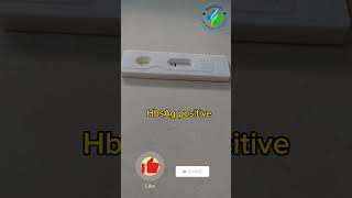 HbsAg Test  Hbsag Positive  hbsAg test  What is Hepatitis B Surface Antigen  Hepatitis B virus [upl. by Anahsek]