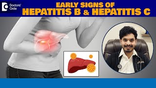 Early WARNING SIGNS of Hepatitis B amp C  World Hepatitis Day DrLeela Mohan PVR  Doctors Circle [upl. by Hollah]