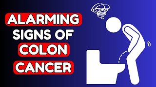 8 Warning Signs of COLON CANCER you Shouldnt Ignore  Nourish Hub [upl. by Kiyohara]