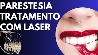 Parestesia e laserterapia [upl. by Felicio]