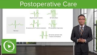 Postoperative Care – Surgery  Lecturio [upl. by Fredie552]