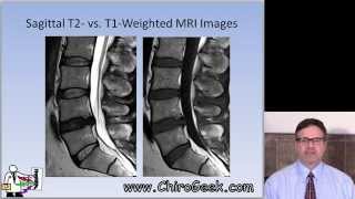 Dr Gillard lectures on How to Read Your Lumbar MRI [upl. by Ardy]