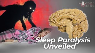 Sleep Paralysis  The Waking NIGHTMARE [upl. by Niple]