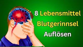 Die 8 besten Lebensmittel zur natürlichen Auflösung von Blutgerinnseln Gesunde Ernährungstipps [upl. by Bluefarb177]